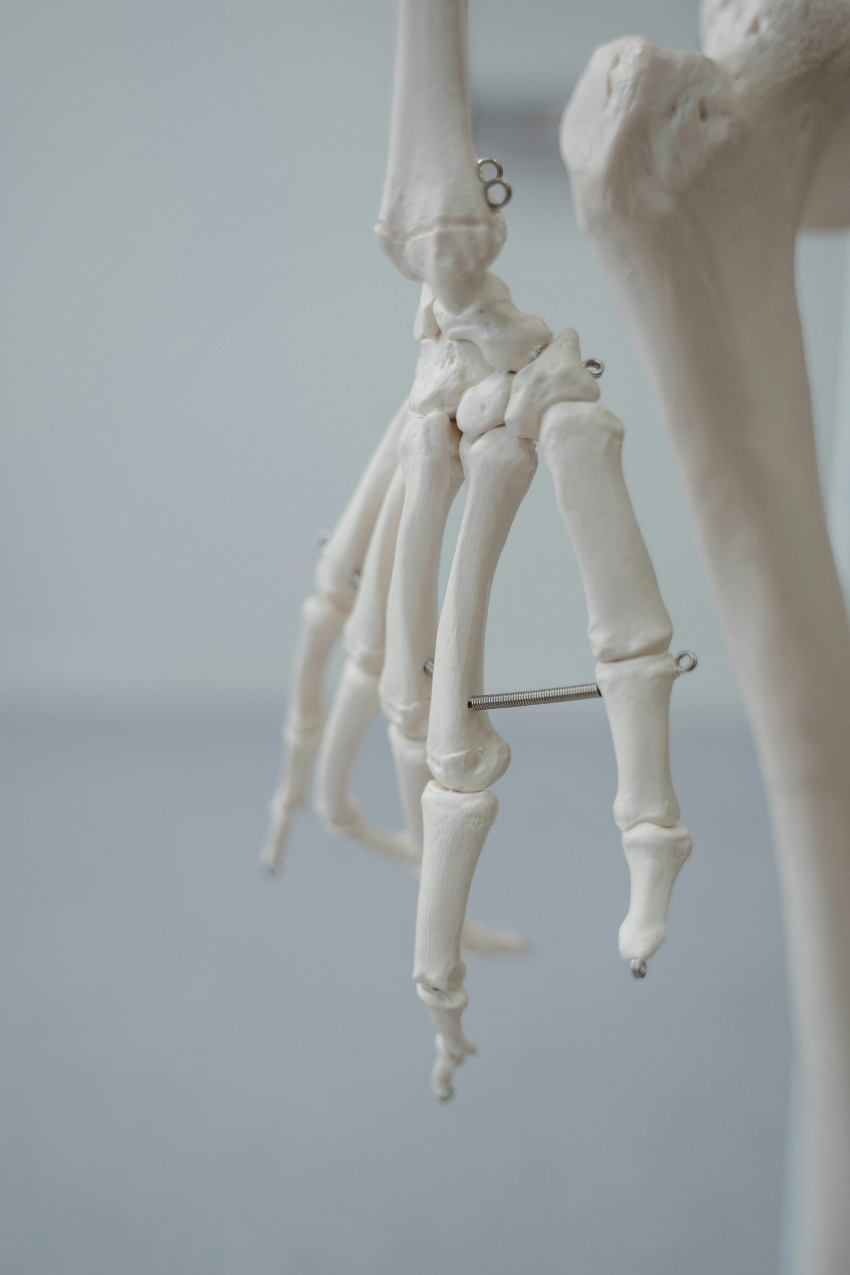 Temps récupération fracture fibula