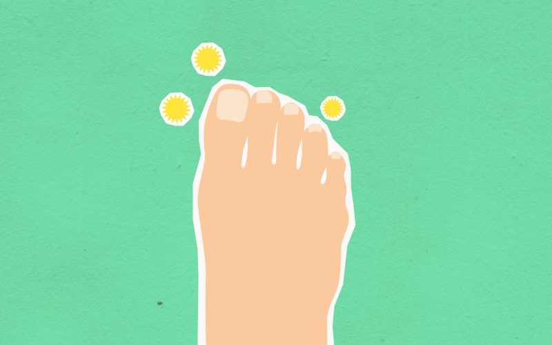 Qu&rsquo;est-ce que l&rsquo;eczéma au pied et comment le traiter ?