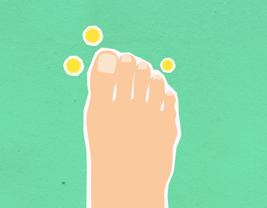 Qu&rsquo;est-ce que l&rsquo;eczéma au pied et comment le traiter ?