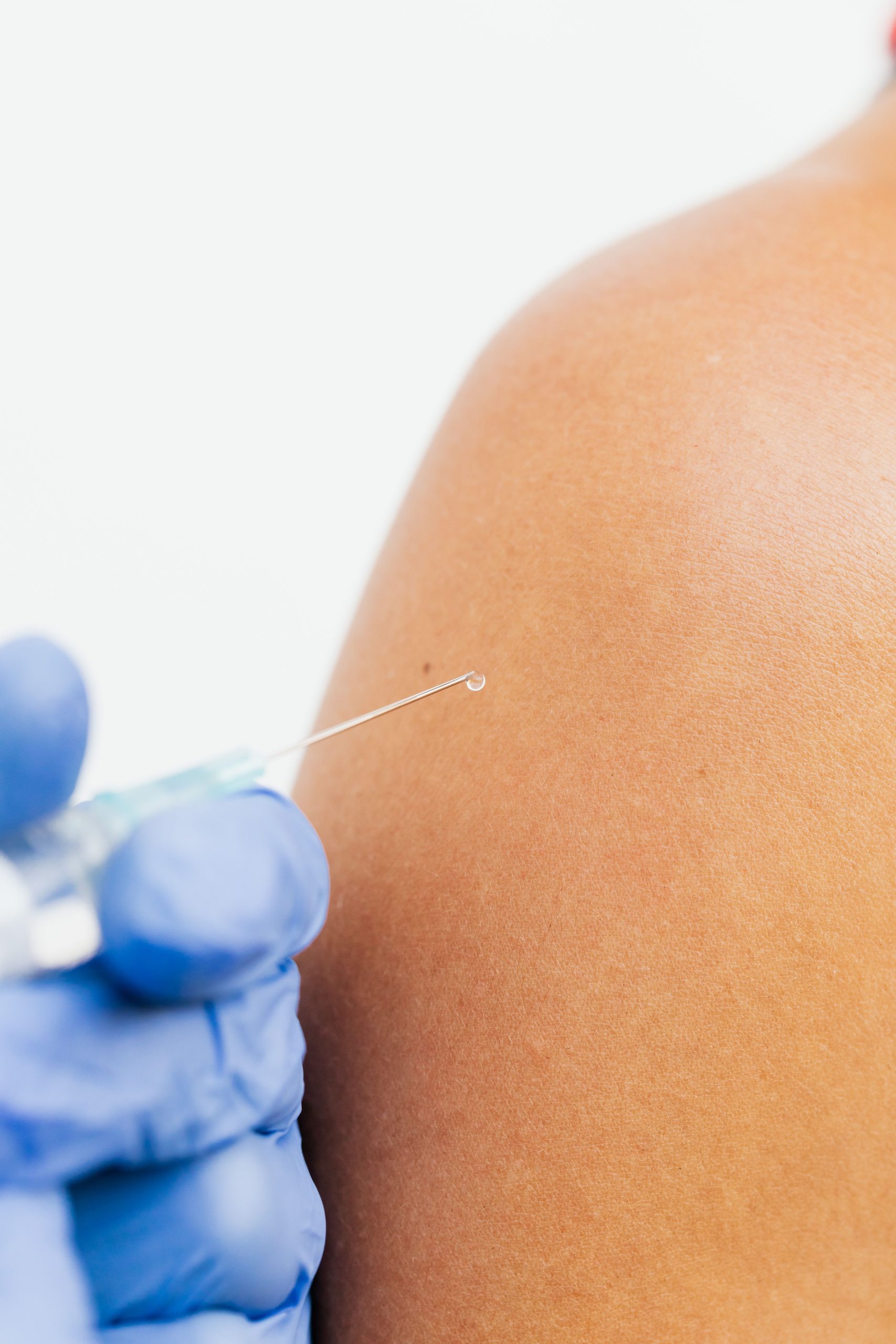 Infiltration pour capsulite rétractile efficacité clinique