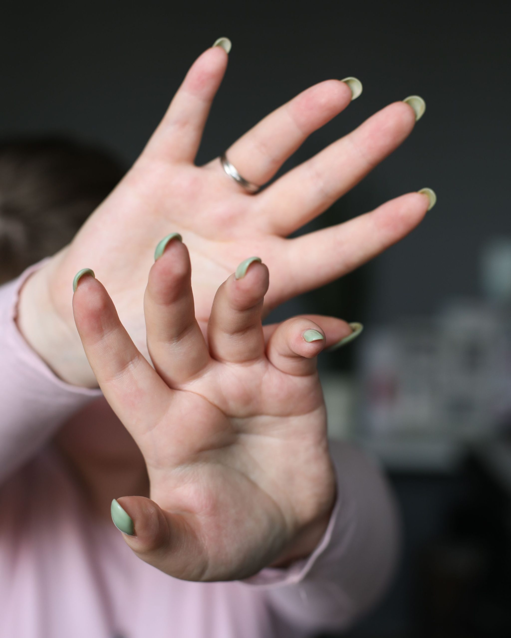 Causes de l'allergie au vernis semi-permanent