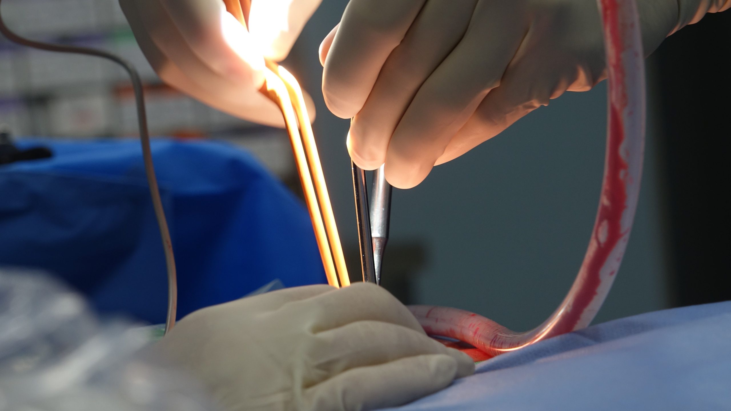 Rabotage prostate effets secondaires