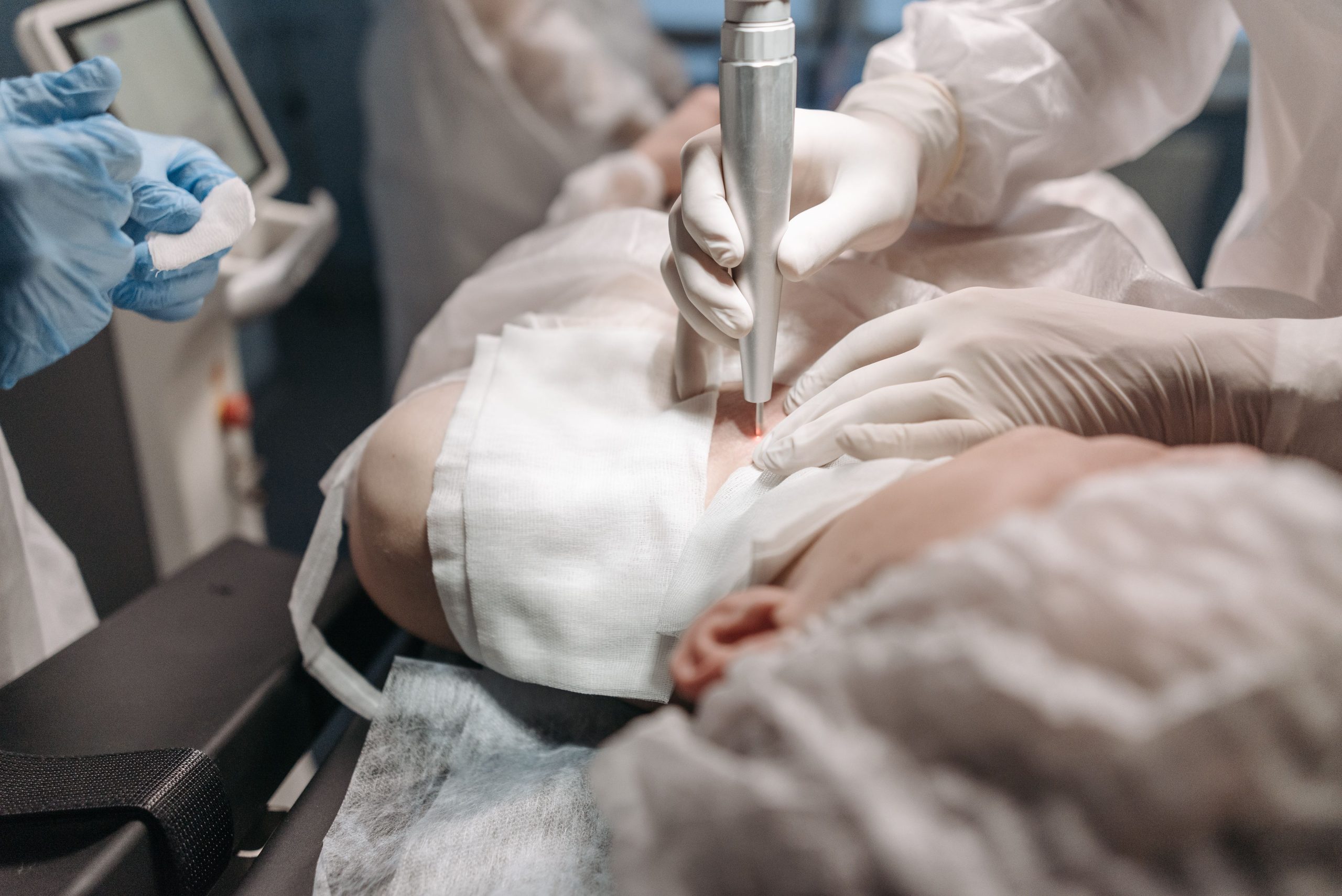 Professionnels medicaux realisant traitement laser peau