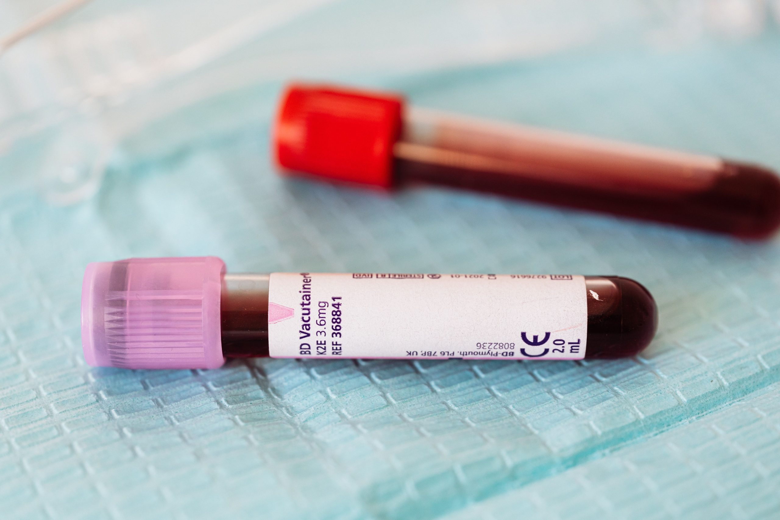 Prélèvements sanguins colorés sur surface médicale