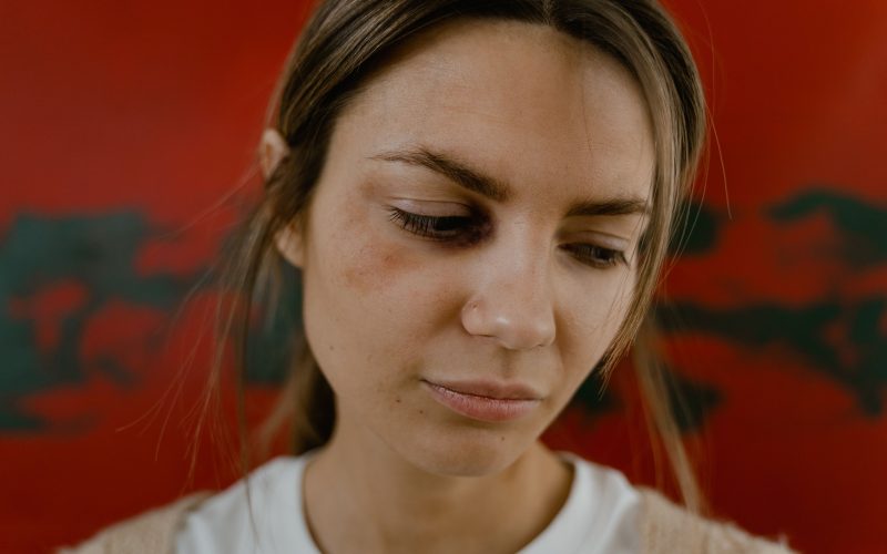 Allergie aux yeux, le gonflement dure combien de temps ?