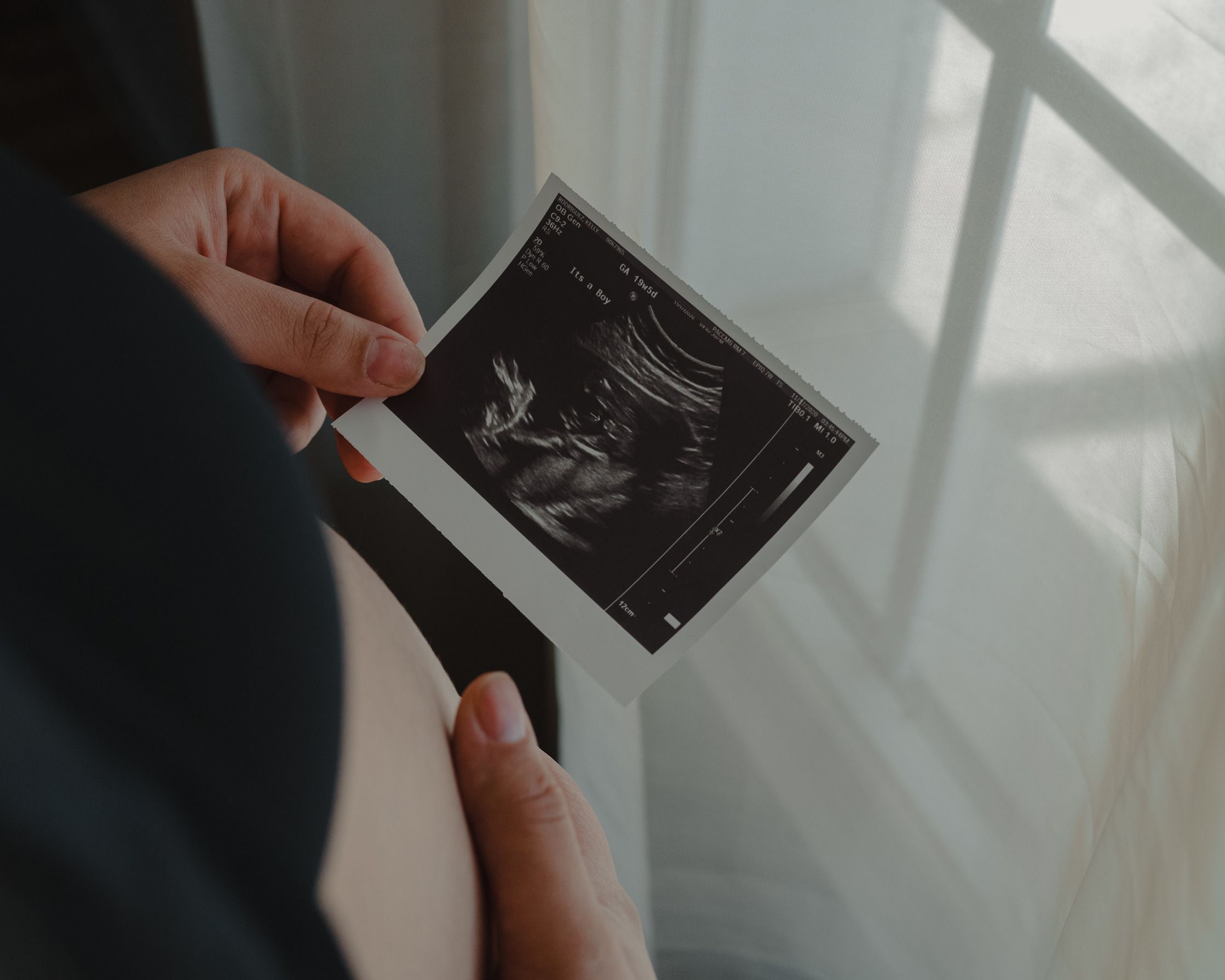 Femme enceinte tenant son échographie entre les mains