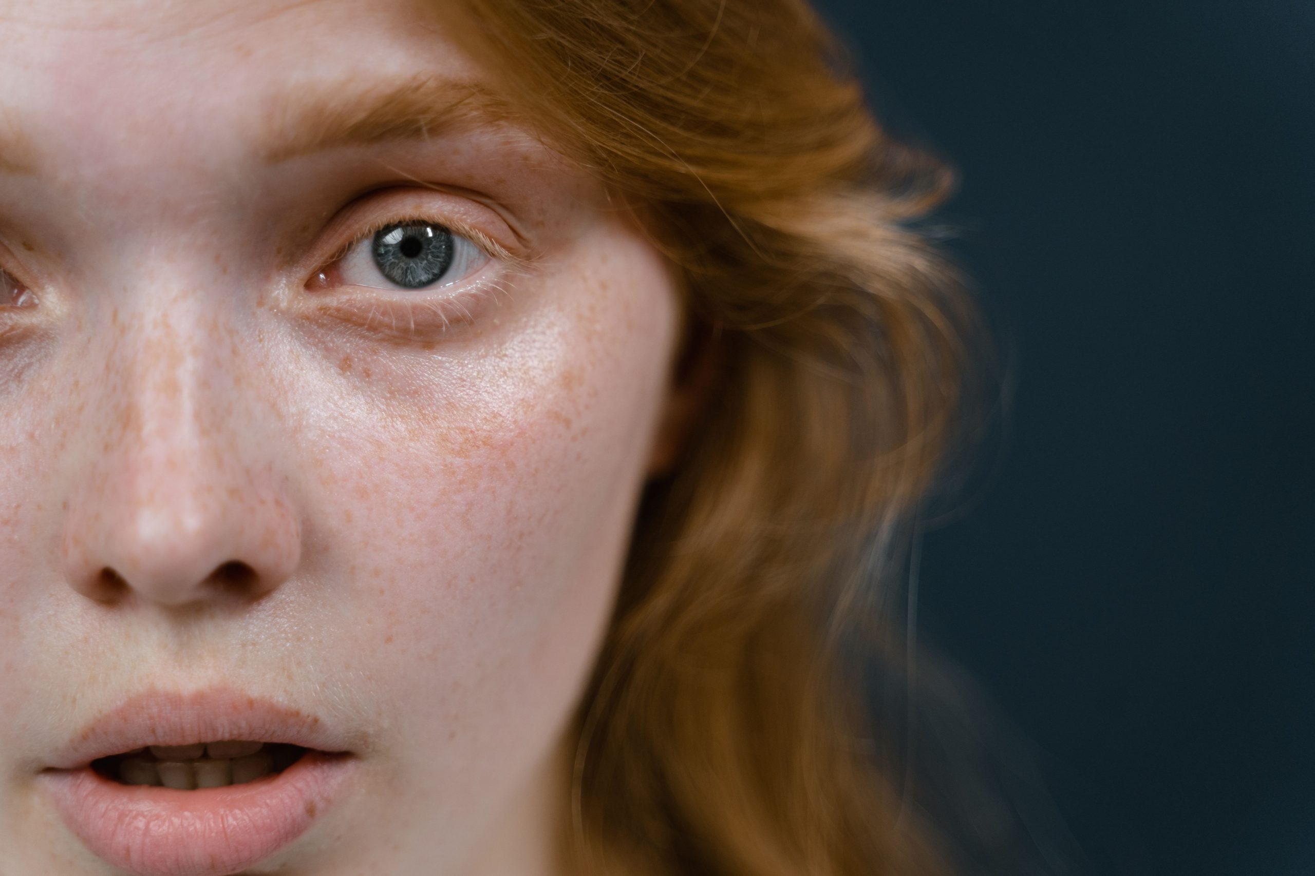 Gros plan visage montrant gonflement oculaire