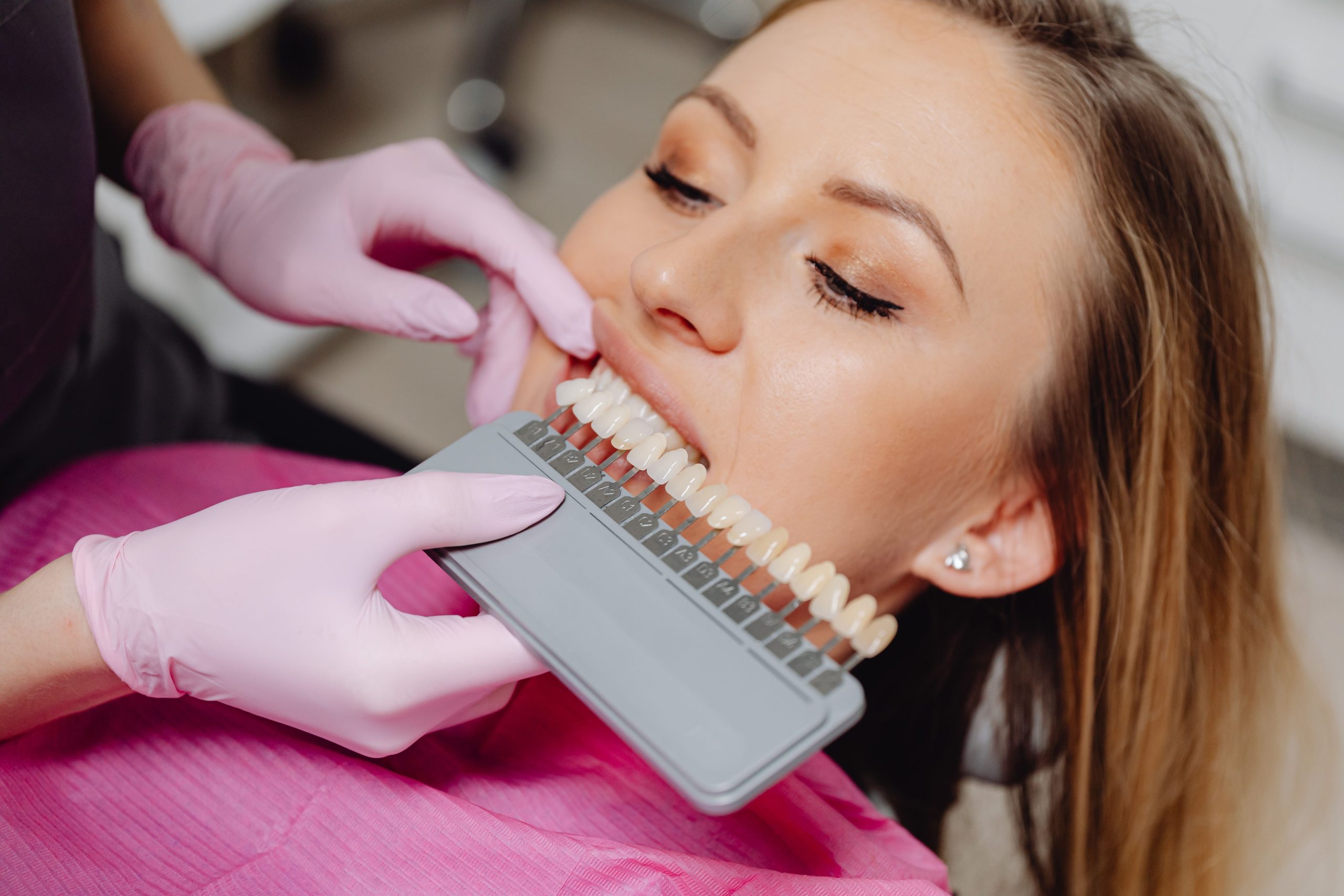 Nuancier dentaire utilisé pour évaluer la teinte des dents