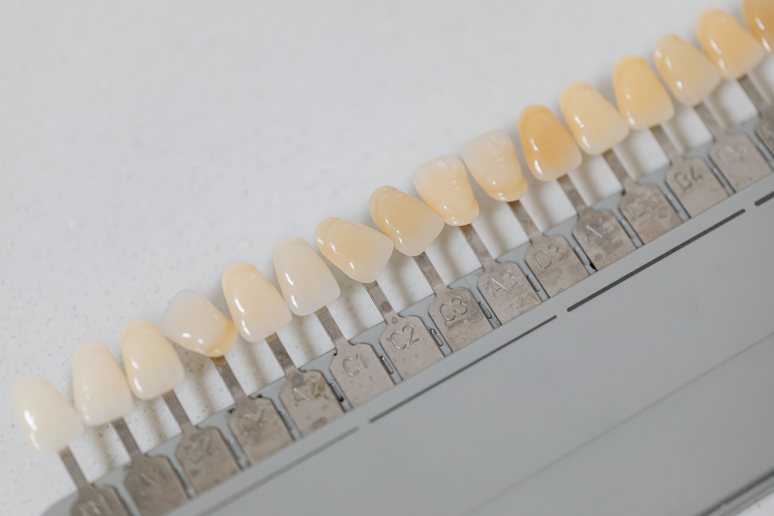 Gros plan sur un nuancier de teintes dentaires