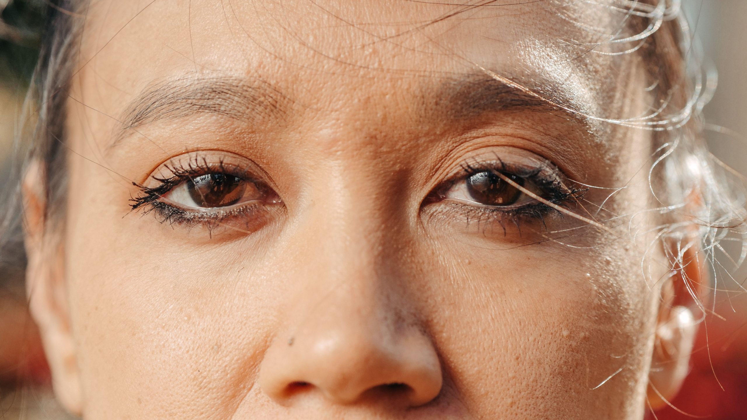 Extrême gros plan yeux gonflés par allergie